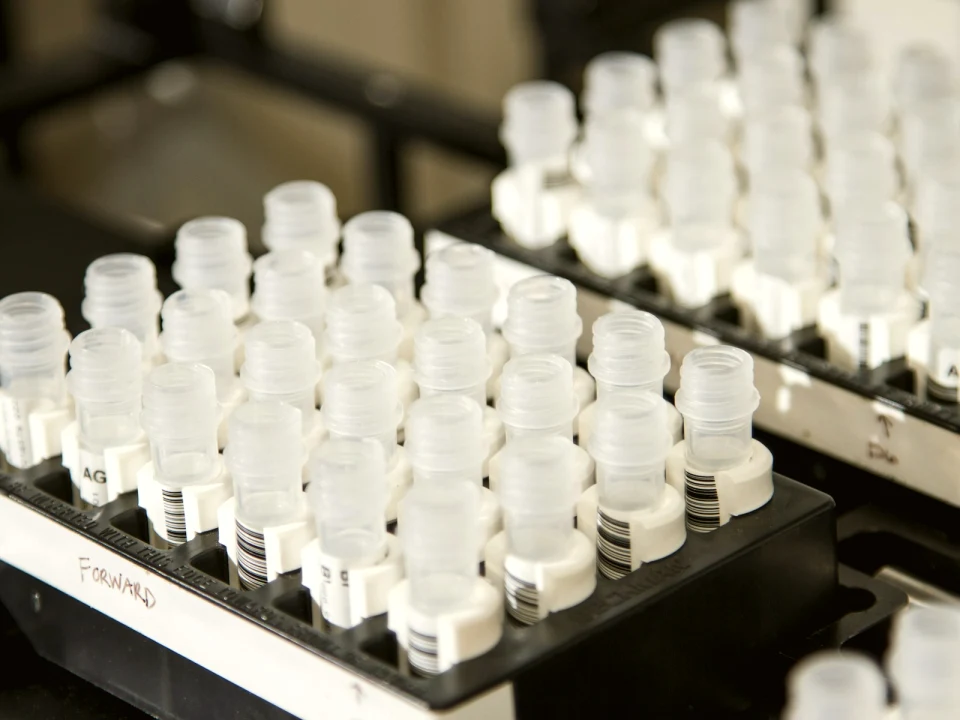 Low Testosterone: Symptoms and Testing