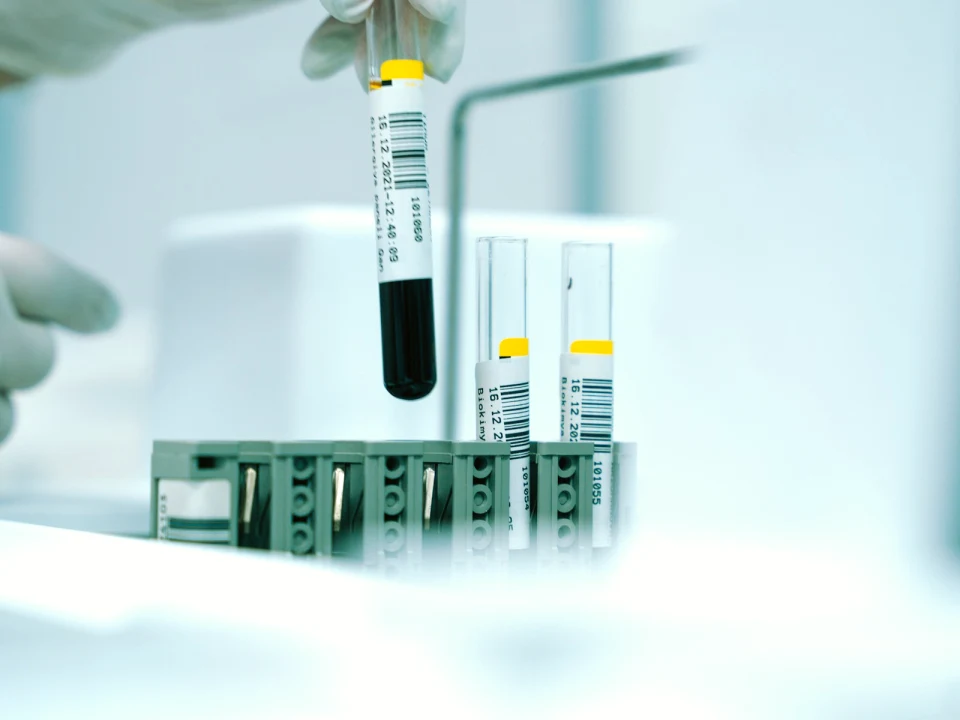 Testosterone, Libido and Fatigue: Basics